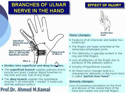 96 U Limb Branches of the ulnar nerve in the hand د أحمد كمال cxt 