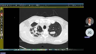 Cardiothoracic case webinar 6 August 2026