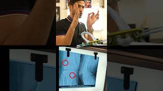 ACL Surgery Costs Explained: ₹30,000 vs ₹3 Lakh || Dr. Manu Bora || ACL Cost