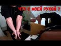 ЧТО С МОЕЙ РУКОЙ ?/ОРЛОВЕЦ