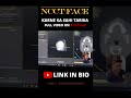 NCCT Face Explained in 30 Seconds 🩻 | Radiology Quick Guide