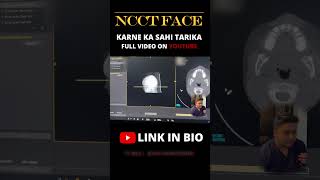 NCCT Face Explained in 30 Seconds 🩻 | Radiology Quick Guide
