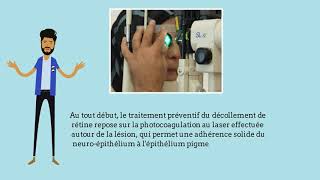 Décollement De La Rétine Symptômes Et Traitement