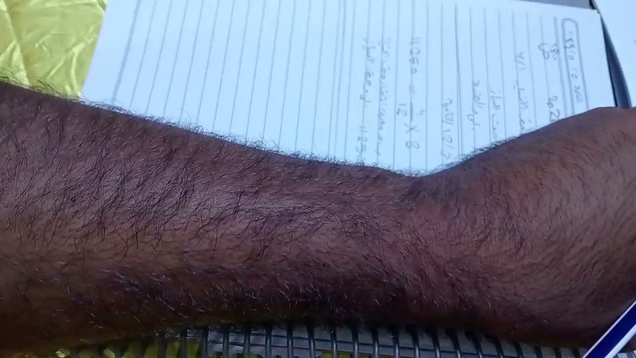 المحاضرة الثانيه من الفصل التاسع الموجودات غير ملموسه محاسبة متوسطه مرحلة ثانيه