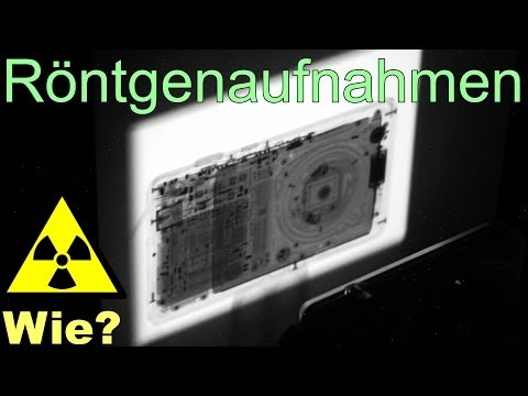 Video: Wann sollten Röntgenaufnahmen montiert werden?