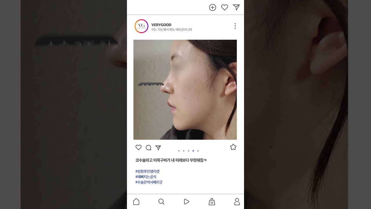 [貝麗古整形外科診所] 比我的未來還要清晰的鼻線條✨