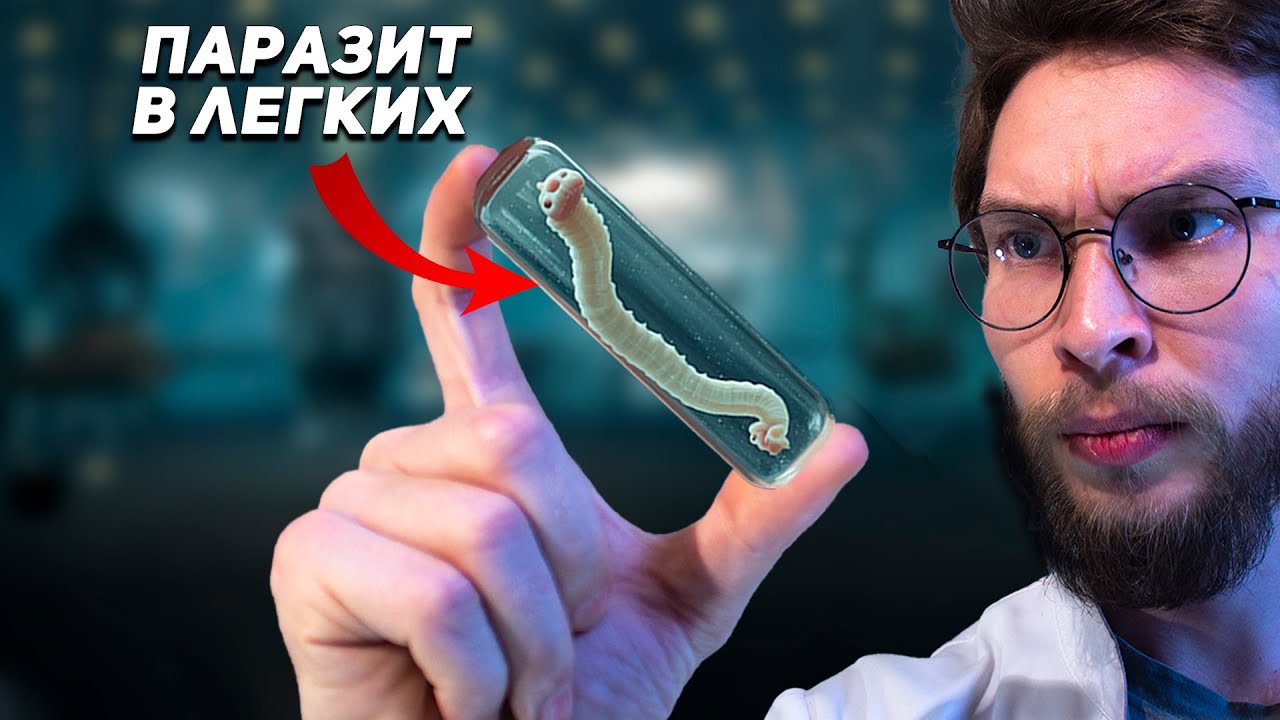 Вот что Произойдет с Паразитом в Человеке. Научный разбор