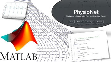 MATLAB Adquisición de datos desde physionet (Ventaneo de señales en 1 dimensión)