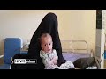 اوچا: افغانستان کې لا هم د زېږون پرمهال د مور او ماشوم مړينه زياته ده