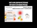 Киста или доброкачественная опухоль в слуховом проходе #киста #опухоль #болитухо #больвушах