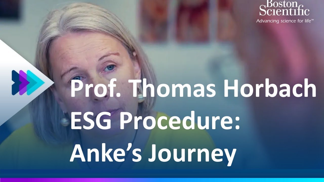 Prof. Thomas Horbach ESG Procedure – Anke’s Journey with Endoscopic Sleeve Gastroplasty