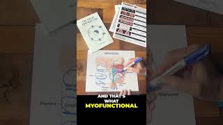 Why Palatal Expansion Is Only Part of the Airway Story