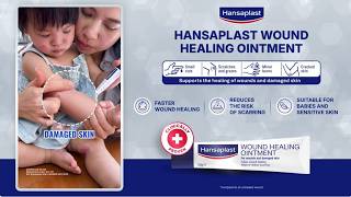 Baby Cracked Skin Relief | Hansaplast Wound Healing Ointment