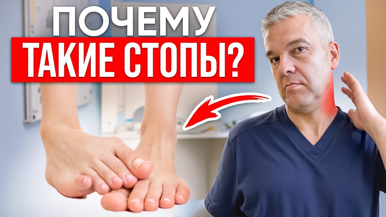 КАК УБРАТЬ ЗАВАЛ СТОПЫ ВО ВНУТРЬ? Самый эффективный способ устранения проблемы