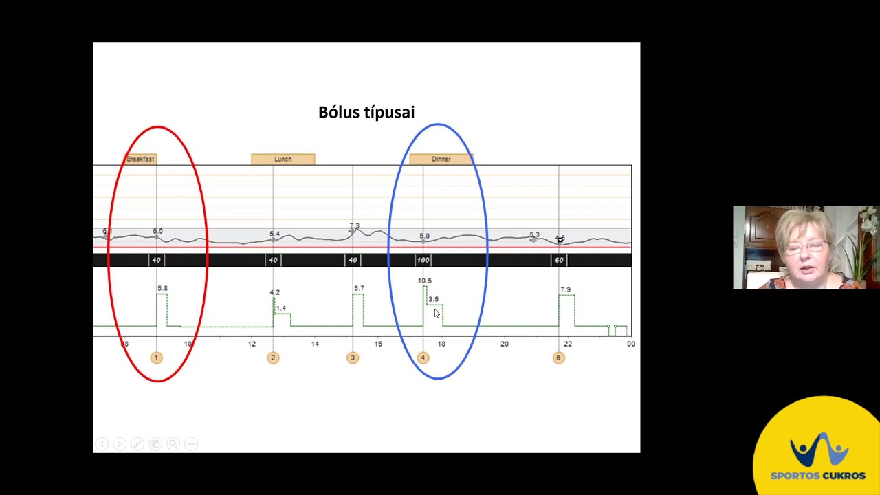 Dr.  Hocsi Mária -  Inzulinpumpa alapképzés