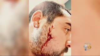 Sausalito Neighbors On Edge After Series Of Vicious Dog Attacks