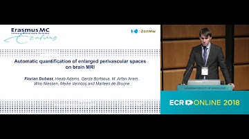 Enlarged perivascular spaces in brain MRI: Automated quantification in four regions