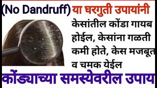 केसातील कोंडा घालवण्यासाठी उपाय || kesatil konda kami karane | dandruff treatment ||