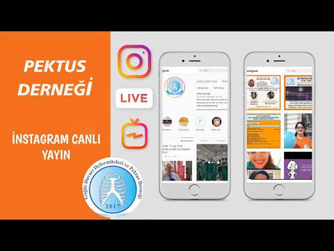 🔶”Pektus Karinatum   (Güvercin Göğsü) Tedavisinde  ORTEZ mi?  AMELİYAT mı?”