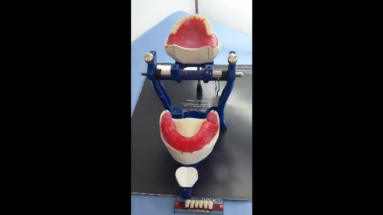 Setting of Anterior mandibular teeth - YouTube