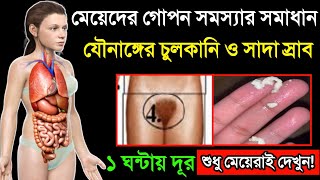 মেয়েদের গোপনাঙ্গে চুলকায় কেনো | যৌনাঙ্গের চুলকানির কারন ও লক্ষণ কি | চুলকানি দূর করার ঘরোয়া উপায়