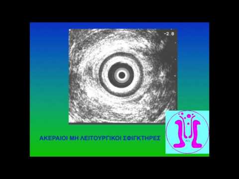 ΑΚΡΑΤΕΙΑ ΚΟΠΡΑΝΩΝ - ΑΠΟΣΤΟΛΟΣ ΣΤΑΜΑΤΙΑΔΗΣ