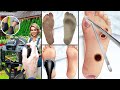 Foot Surgery & Skincare Animation – Satisfying Restoration #asmr