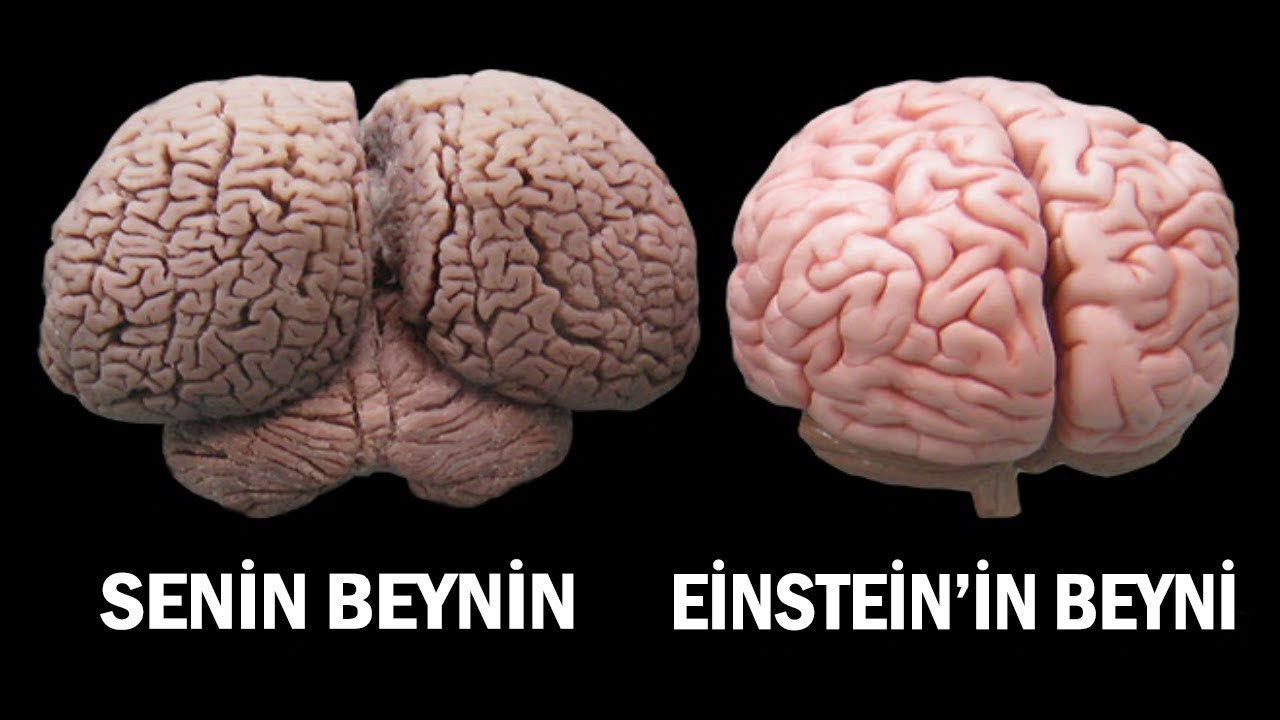 Мозги украду. Обычный мозг мозг Эйнштейна. Вес мозга Эйнштейна.