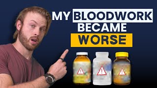 The Most Overrated Supplement of All (Better Alternatives to Multivitamins)