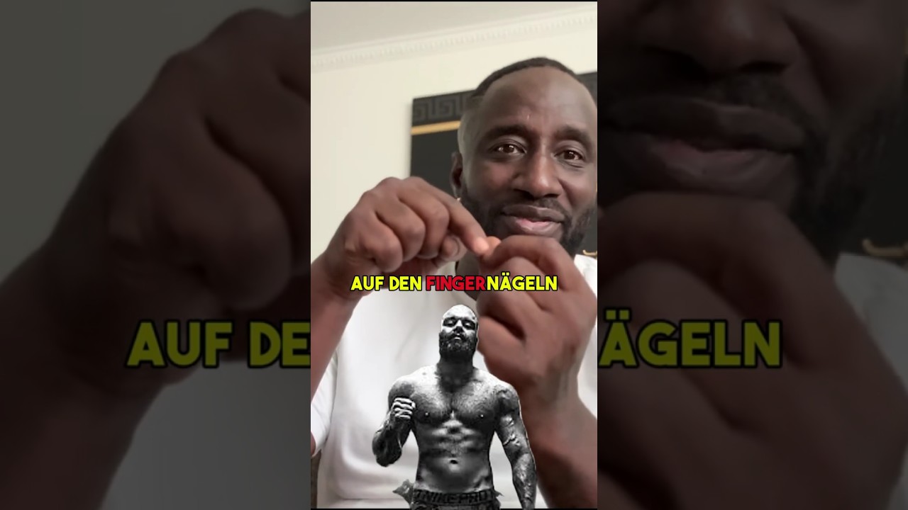 „DU HATTEST HAARE AUF DEN FINGERÄGELN!“ – MANU ÜBER ANIMUS 😂