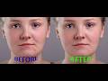 Photoshop Retuch Tutorial|Retuching Photo in Photoshop