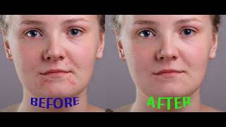 Photoshop Retuch Tutorial|Retuching Photo in Photoshop