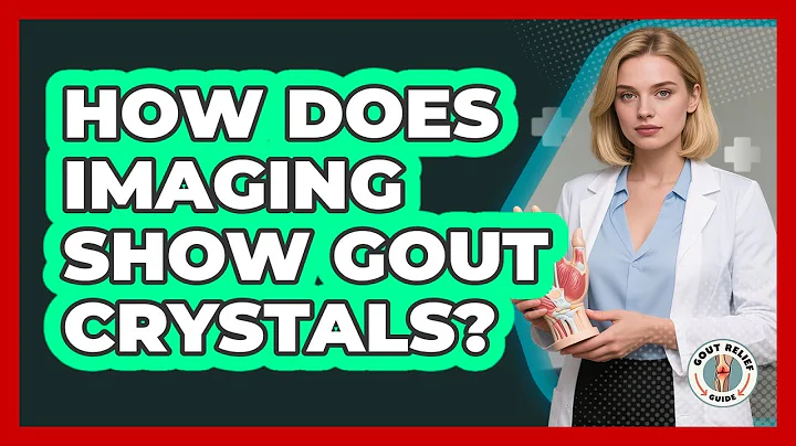 How Does Imaging Show Gout Crystals? - Gout Relief Guide