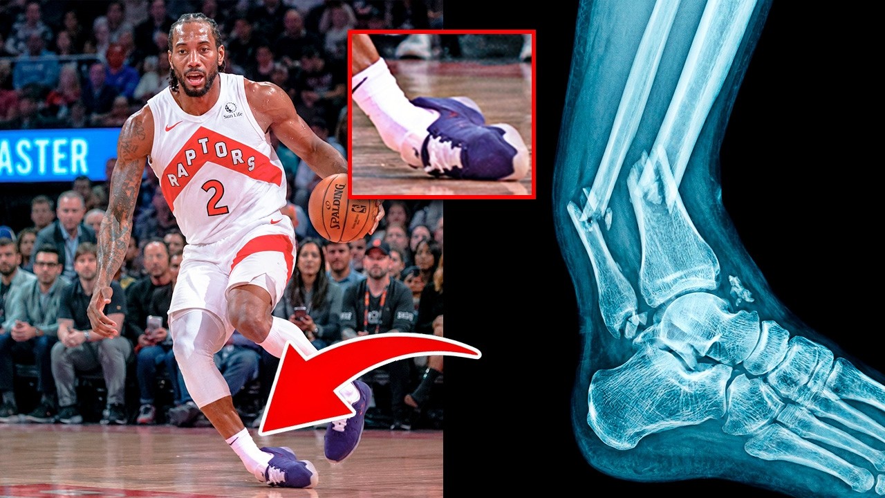 Kawhi Leonard INJURED Just Hours After Being TRADED to TORONTO
