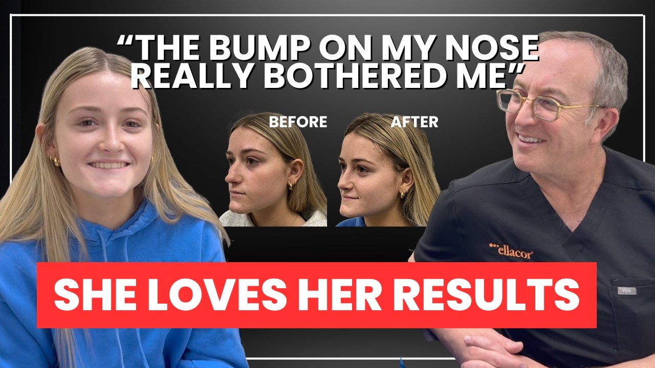 Nose Job Transformation That Changed Her Confidence - YouTube