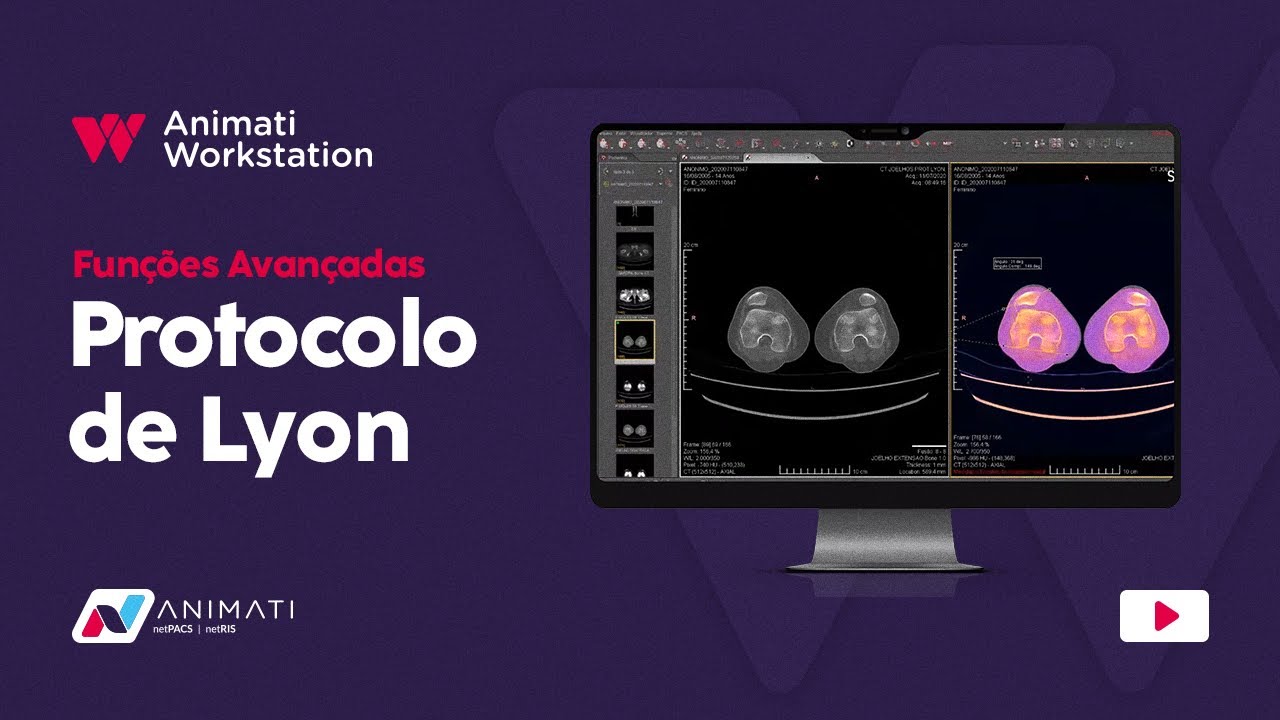 Animati Workstation - Protocolo de Lyon