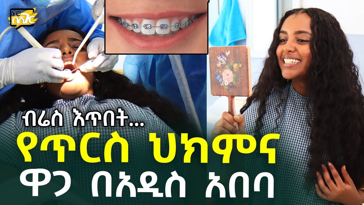 የጥርስ ህክምና ዋጋ በአዲስ አበባ Dental Clinic Price in #AddisAbaba #Ethiopia #Habesha Nuro BeSheger brace