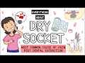 Dry Socket (After tooth extraction): All you need to know