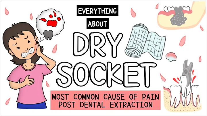 Dry Socket (After tooth extraction): All you need to know - DayDayNews
