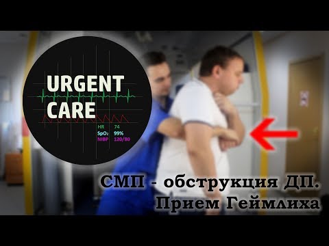 СМП - Обструкция дыхательных путей. Прием Геймлиха