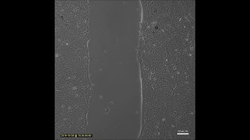 Wound healing assay with HaCaT keratinocytes using Culture-Inserts