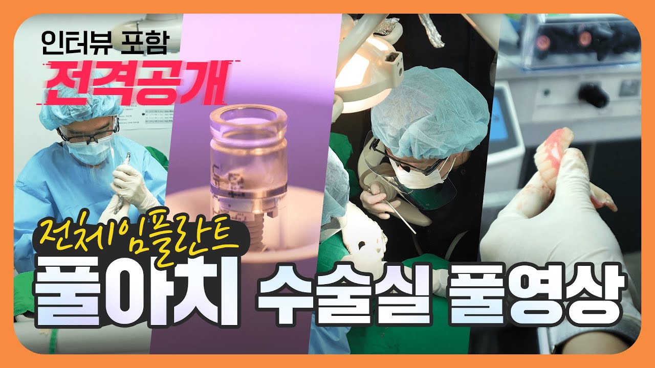 1,2화 풀영상 풀아치 전체임플란트 수술실 안에서.. 전격공개 (인터뷰 포함)