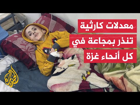 تقرير حالة انعدام الأمن الغذائي: 96% من سكان غزة يواجهون مستويات مرتفعة من انعدام حاد للأمن الغذائي