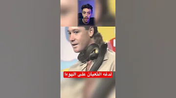 شاهد مدرب لدغه ثعبان على البث المباشر Shorts 