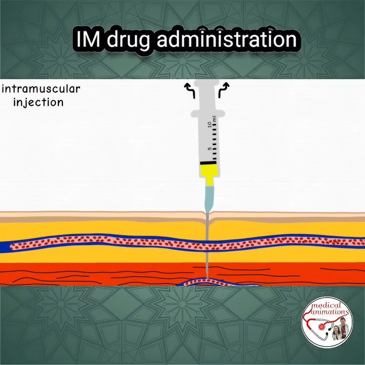 💉 INTRAMUSCULAR (IM) INJECTION, PROCEDURE | ANIMATED EXPLANATION