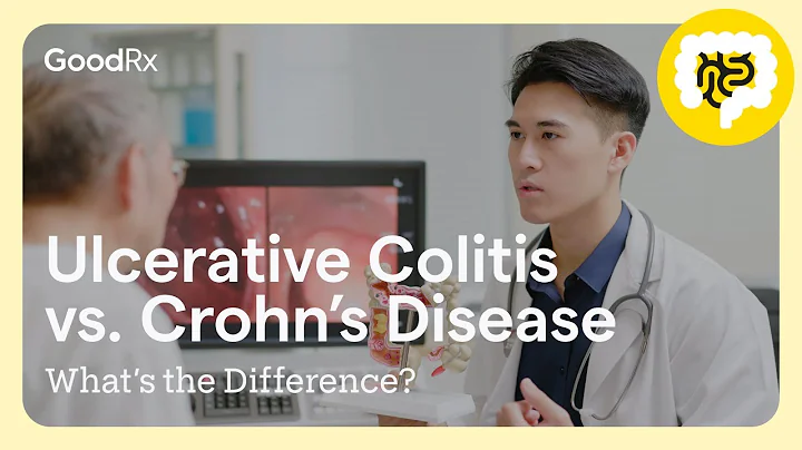 Ulcerative Colitis vs. Crohn’s Disease: What’s the Difference? | GoodRx