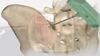 Magellan MAR0Max Training Video