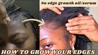 How To REGROW Your DISAPPEARING EDGES & Keep Them From BREAKING OFF Again | No Edge Growth oil