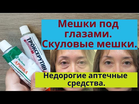 Мешки под глазами, малярные мешки, отеки глаз. Бюджетные аптечные средства от мешков под глазами.