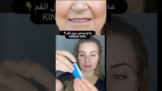 علاج تجاعيد حول الفم kinesio Tape #خلطات_مجربة #shortvideo #kinesio #kinesiotape